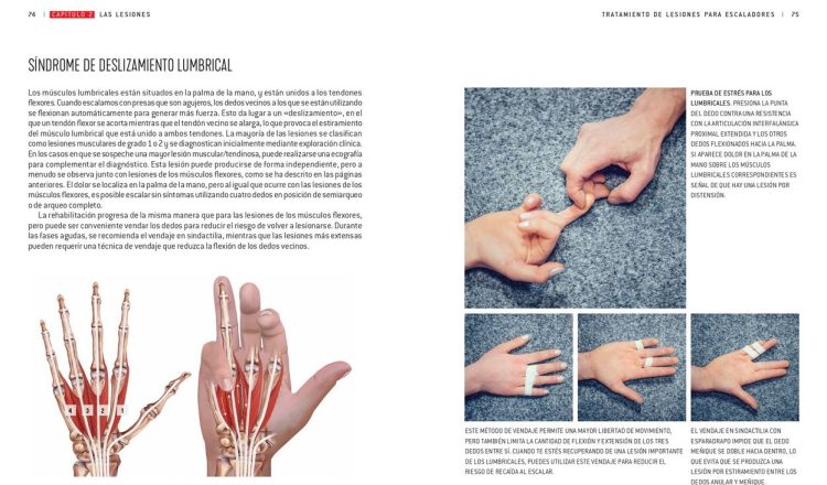 Tratamiento de lesiones para escaladores